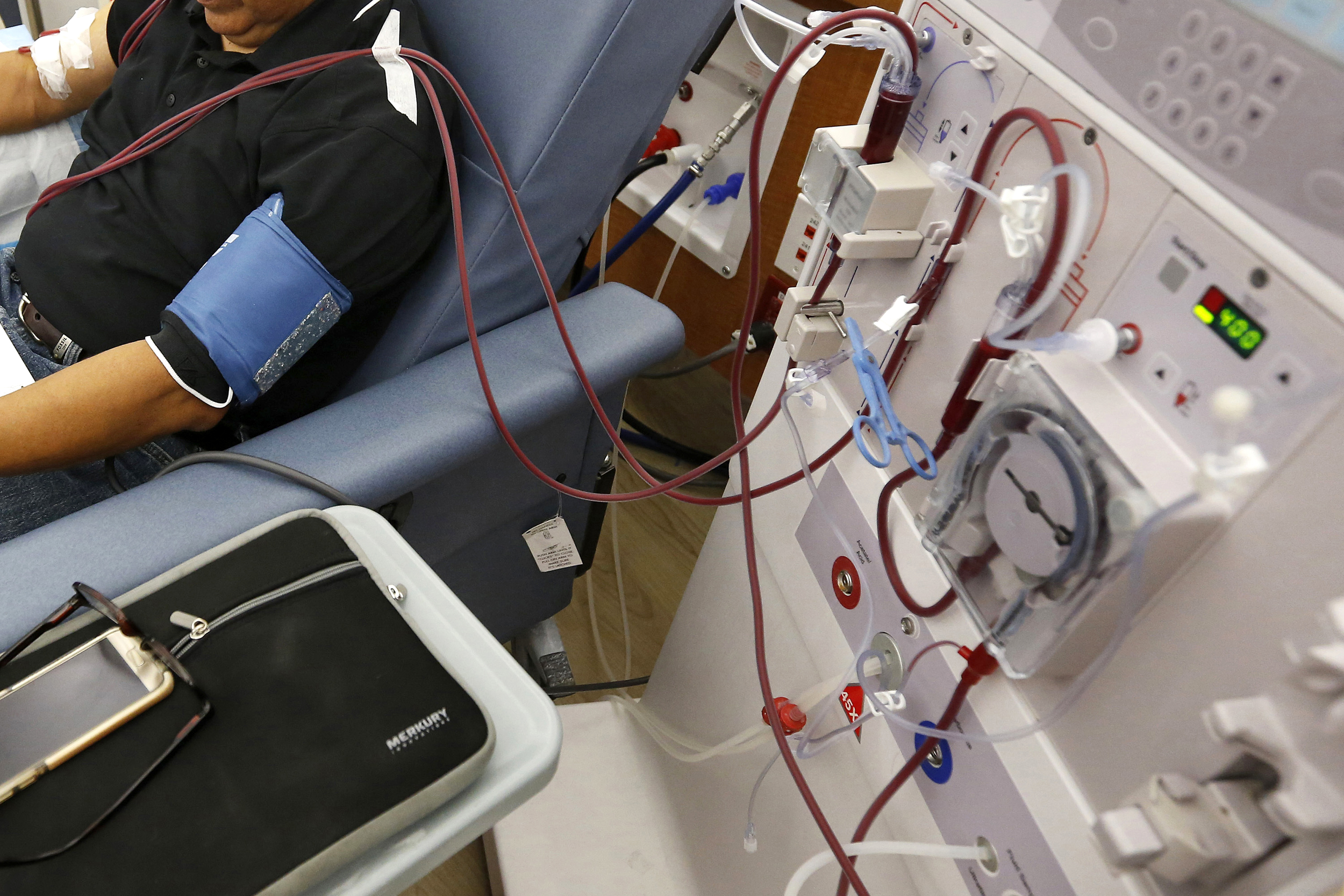 FILE - In this Monday, Sept. 24, 2018 file photo, a patient undergoes dialysis at a clinic in Sacramento, Calif. Results of a study released on Sunday, April 14, 2019 show that the diabetes drug Invokana has been shown to help prevent or delay worsening of kidney disease, which causes millions of deaths each year and requires hundreds of thousands of people to use dialysis to stay alive. (AP Photo/Rich Pedroncelli)