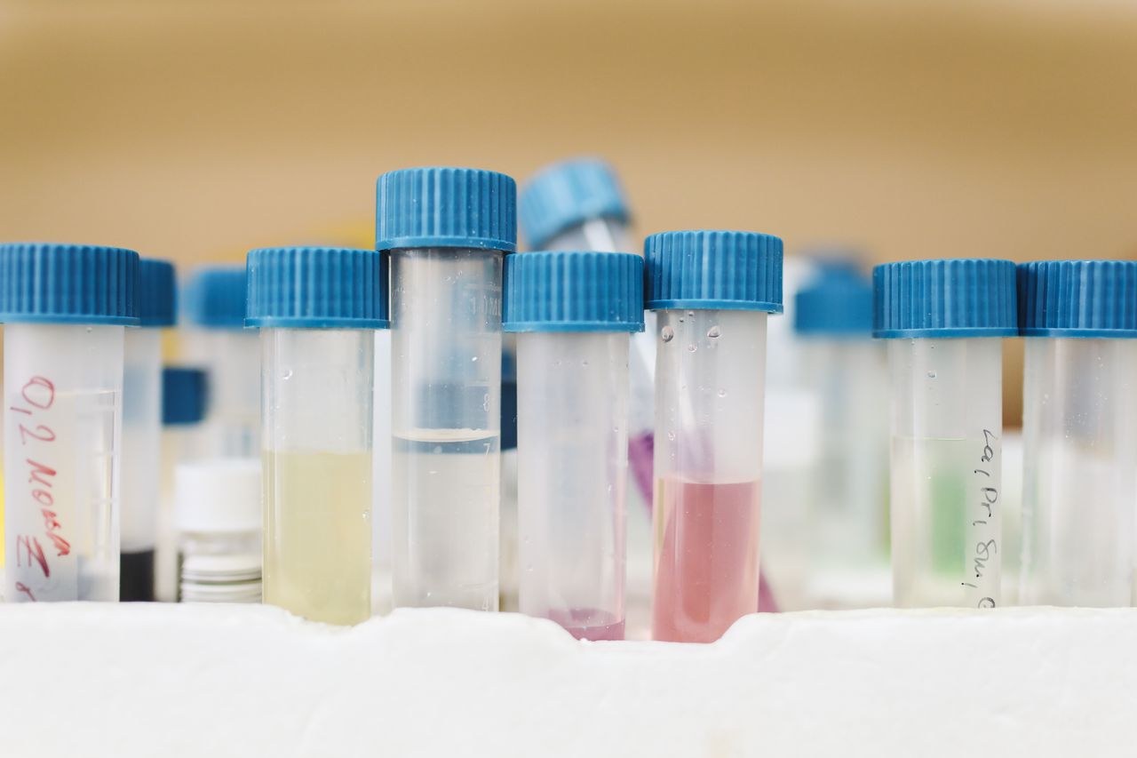is stage 3 kidney disease reversible